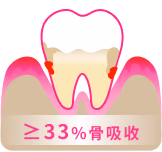 重度牙周病