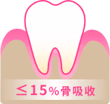 輕度牙周病