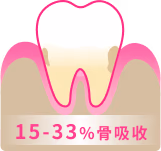 中度牙周病